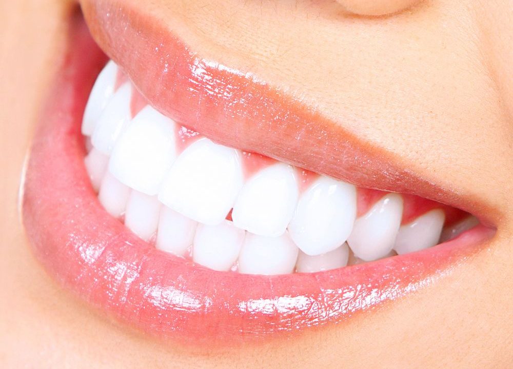 Straightening Your Smile: The Advantages of Invisalign in Sheffield